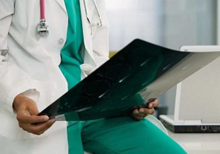Rentgen bo zdravniku pomagal diagnosticirati osteohondrozo torakalne hrbtenice